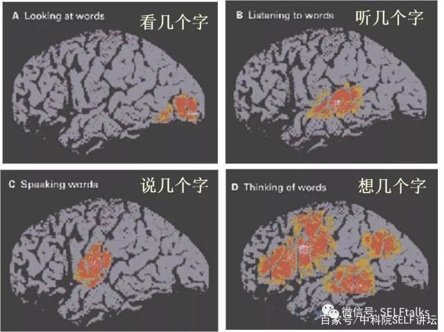 中國(guó)腦健康日關(guān)注“頭”等大事,中國(guó)腦科技的未來(lái)是什么?